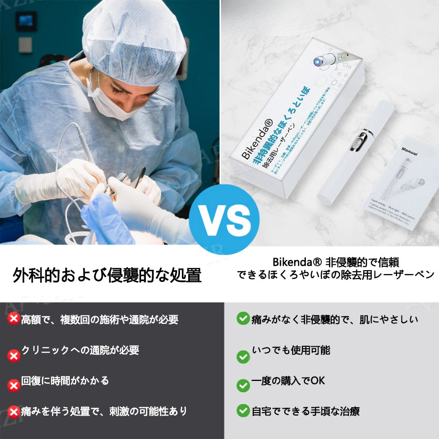 【代引きOK】Bikenda® 非侵襲レーザーペン｜自宅で安全にほくろ・いぼをケア✨