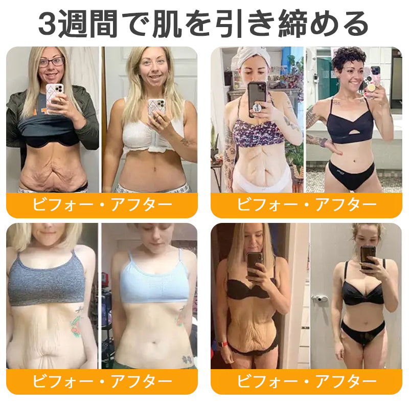 【代金引換可】🌿 TLOPA® 蜂毒スキンリペアクリーム 🔥【最終日】本日限定 80%オフ！🏅
