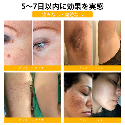 🏵️TLOPA®日本皮膚科学会推薦の蜂毒配合薬用スキンクリーム🔥