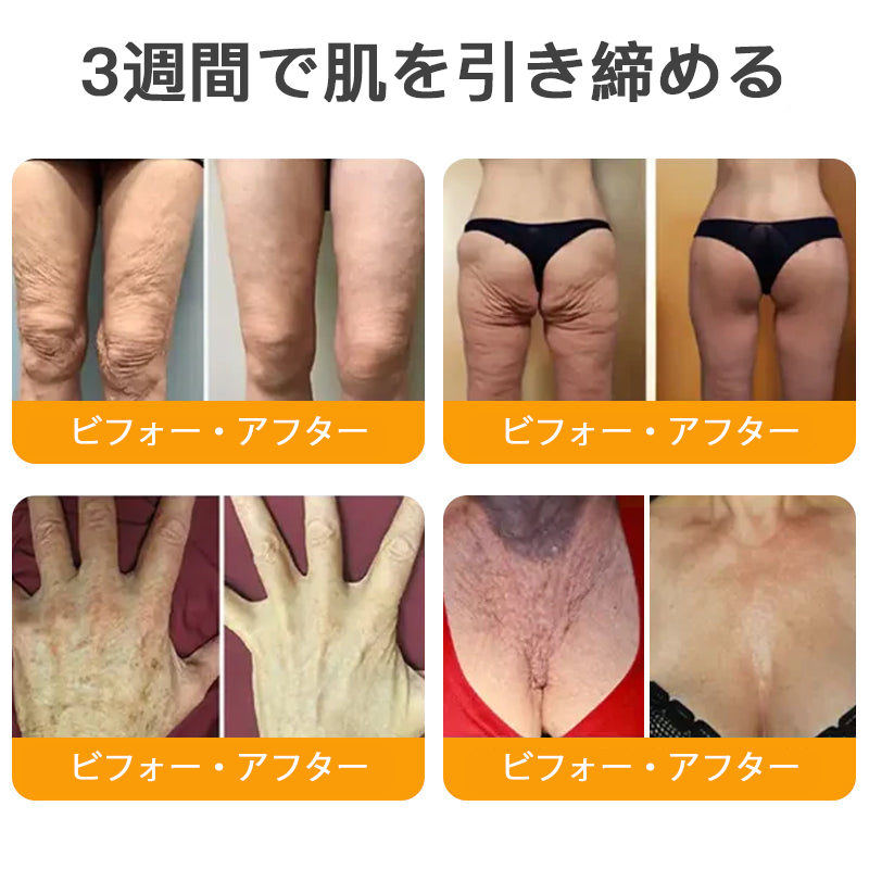【代金引換可】🌿 TLOPA® 蜂毒スキンリペアクリーム 🔥【最終日】本日限定 80%オフ！🏆