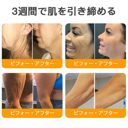 【代金引換可】🌿 TLOPA® 蜂毒スキンリペアクリーム 🔥【最終日】本日限定 80%オフ！🏆
