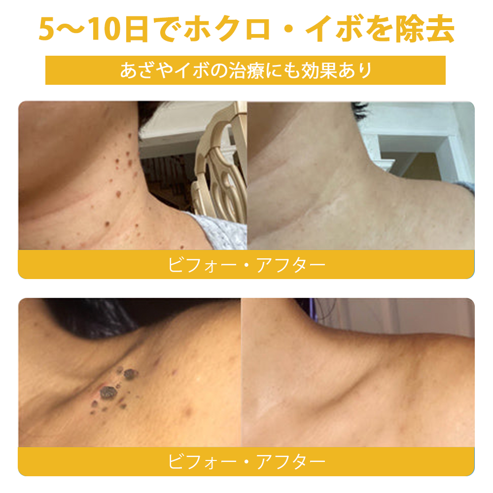 🏵️TLOPA®日本皮膚科学会推薦の蜂毒配合薬用スキンクリーム🔥