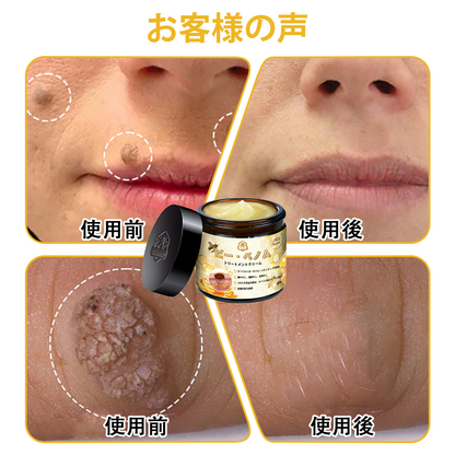 🏵️TLOPA®日本皮膚科学会推薦の蜂毒配合薬用スキンクリーム🔥