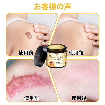 🏵️TLOPA®日本皮膚科学会推薦の蜂毒配合薬用スキンクリーム🔥