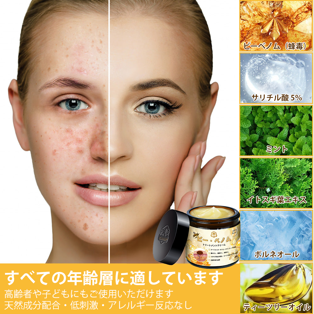🏵️TLOPA®日本皮膚科学会推薦の蜂毒配合薬用スキンクリーム🔥